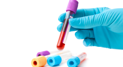 immagine dell'articolo